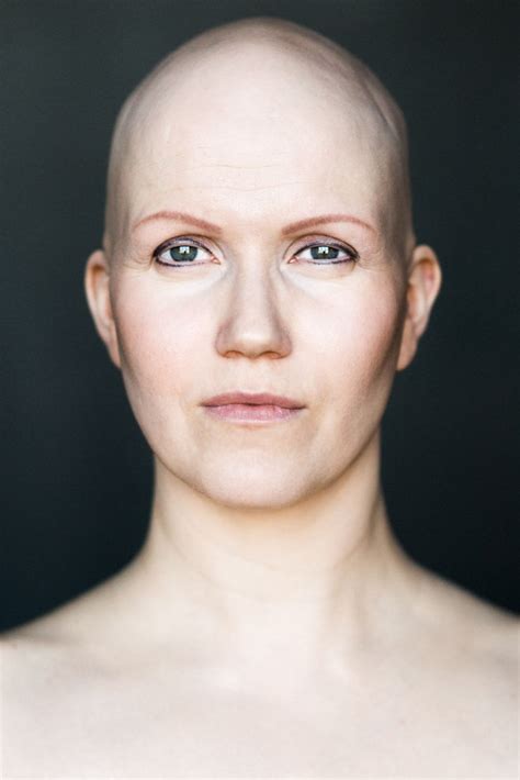 women with alopecia captured in beautiful pictures challenging gender