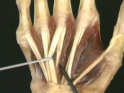 short intrinsic muscles of the fingers acland s video