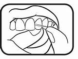 Bicarbonate Astuces Soude Flossing Paperblog Mains Ongles Dentalsreview Floss sketch template