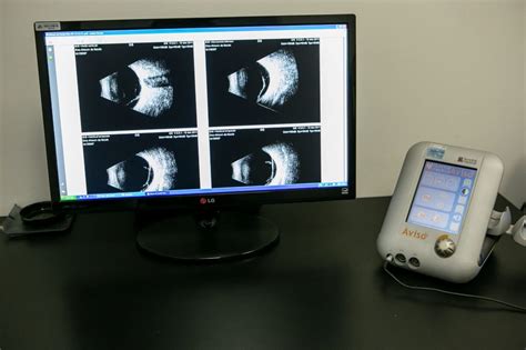 ecografia ocular centro de oftalmologia avançada
