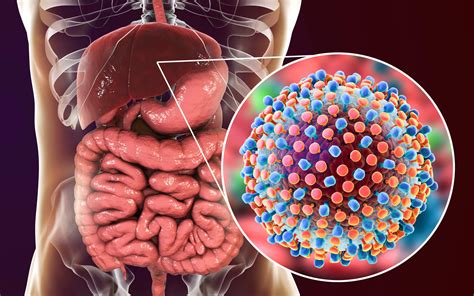 managing hepatitis   treatment naive patients  hiv