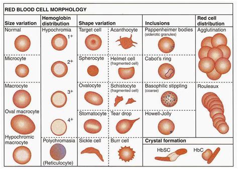 medical laboratory  biomedical science red blood cell morphology