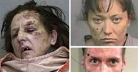 Revealed The Horrors Of Crystal Meth Most Shocking Ever Before And