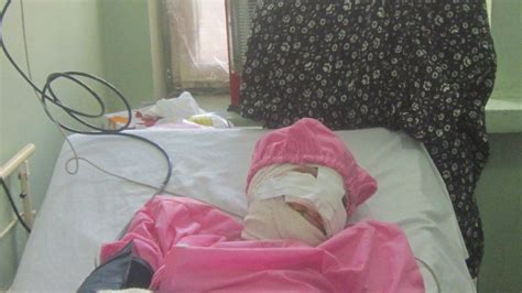 afghan woman s ears cut off by husband bbc news