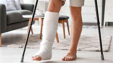 managing  broken leg  injury  healing