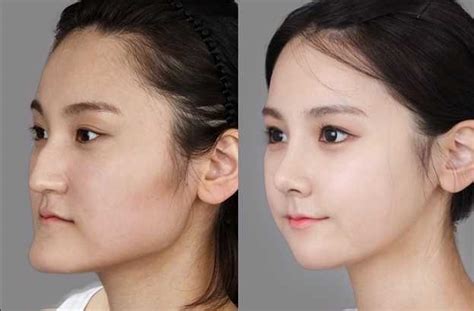 【画像】韓国の超美女たちの ”整形前の顔” 、もはや誰だか分からないレベル・・・ ポッカキット