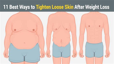 11 best ways to tighten loose skin after weight loss 5 minute read