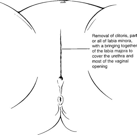 Women S Genitalia Diagram