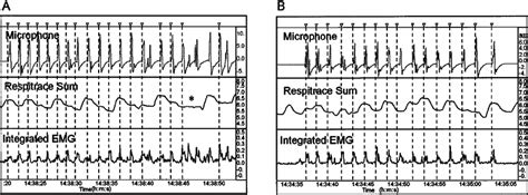 respiratory pattern associated with swallowing during 2 drinking tasks