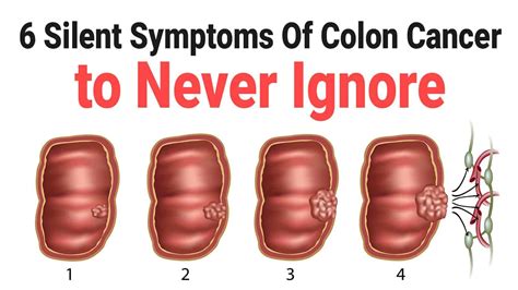 6 silent symptoms of colon cancer to never ignore power of positivity