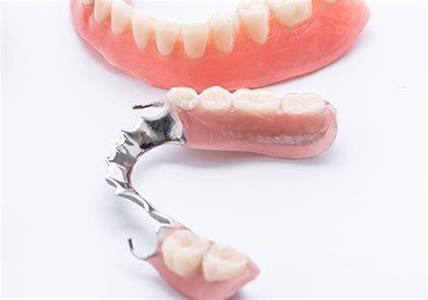 partial dentures garland tx restorative solutions garland dentist