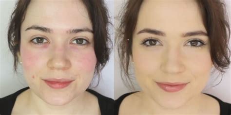 How To Cover Up Rosacea Makeup Tutorial For Concealing Redness