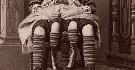 The Most Famous Circus Freaks From Sideshow History