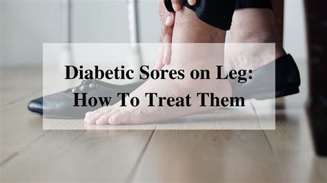 diabetic sores  legs  diagnosis  prevention tips