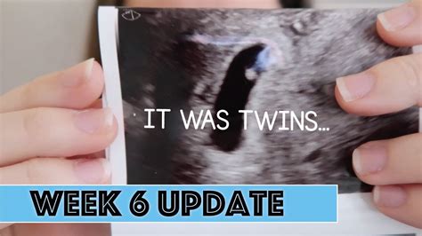 it was twins 6 week pregnancy update the hebert house youtube