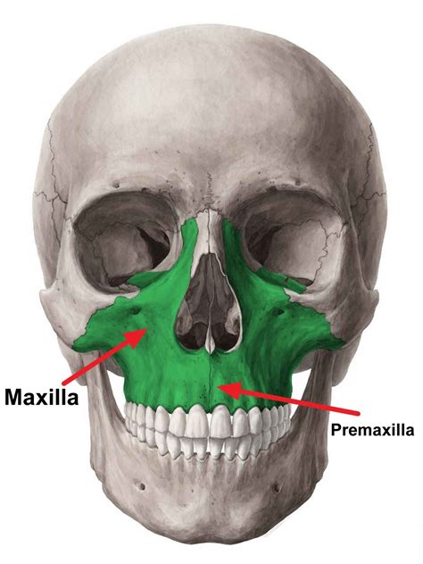 maxillary hypoplasia  symptoms diagnosis treatment prognosis