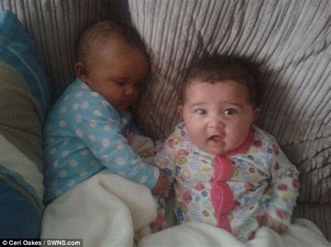 First Identical Twins With Different Skin Colour Born In
