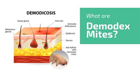 demodex mites face mite hair mite ungex clipzuicom
