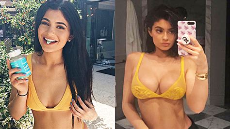 Did Kylie Jenner Get Breast Implants See Before And After Photos