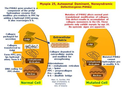 myopia 25 autosomal dominant nonsyndromic hereditary ocular diseases