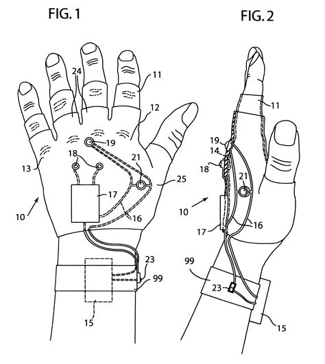 patent  stun glove google patents