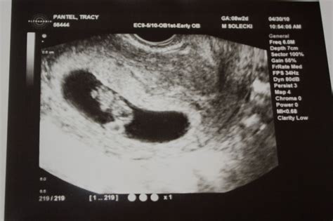 pantel family blog  week ultrasound