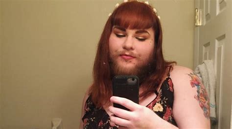 woman with pcos embraces her facial hair after shaving for 14 years to