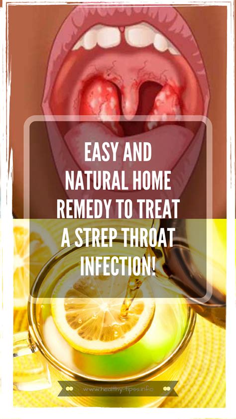 easy  natural home remedy  treat  strep throat infection