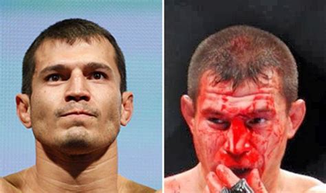 Ufc Fighters Before And After A Fight 15 Pics
