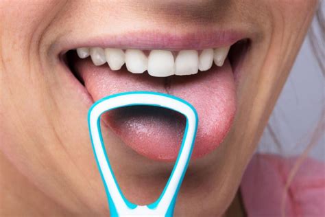 how to clean all on 4 dental implants tips for maintaining good oral