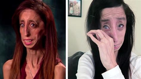 they called her the “ugliest woman alive”—but now she s got a beautiful