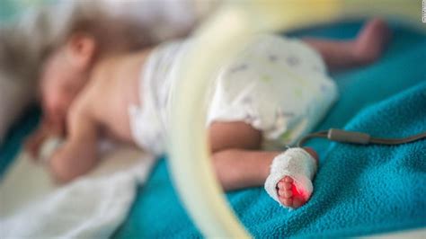 premature babies   greater risk  early death  adults study