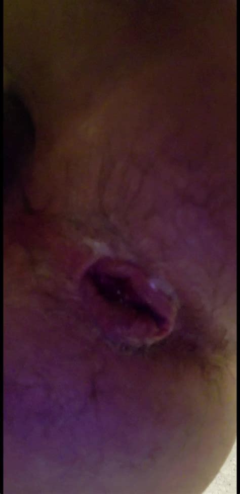 my stretched ass has pussy lips gay porn 55 xhamster
