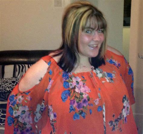 Gastric Band Surgery Failed Kelly Urey Who Says She Was Happier
