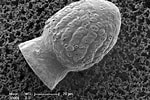 Image result for "codonella Galea". Size: 150 x 100. Source: www.mikrotax.org