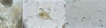 Afbeeldingsresultaten voor "ascampbelliella Obscura". Grootte: 367 x 54. Bron: protist.i.hosei.ac.jp