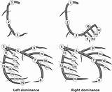 Coronary Segments Artery Classification Graft Figure Surgery Bypass Revascularization sketch template