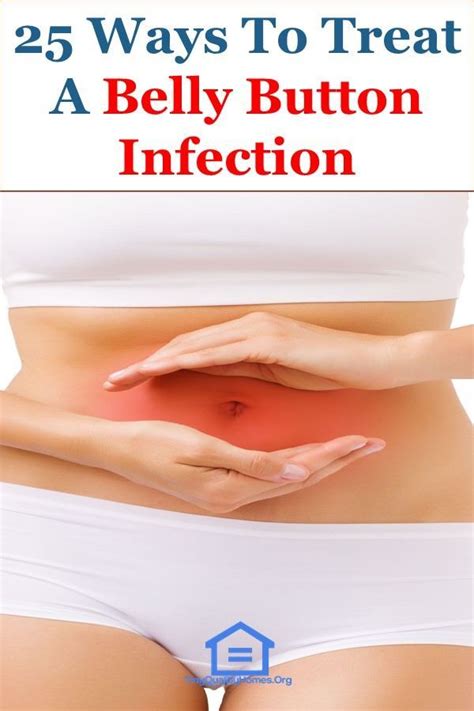 treat  belly button infection  natural remedies