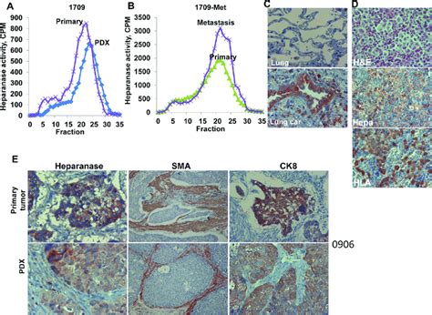 patient derived xenografts pdx maintain characteristics    scientific diagram