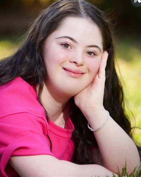 First Down’s Syndrome Model Ellie Goldstein Who Campaigned For Gucci