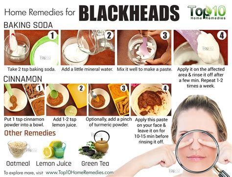 home remedies to get rid of blackheads fast top 10 home