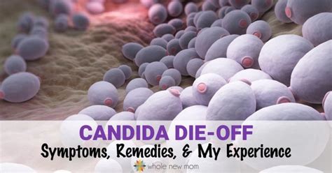candida die    avoid manage   story   mom