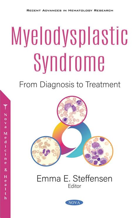 myelodysplastic syndrome from diagnosis to treatment nova science
