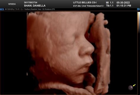 bellies ultrasound pregnancy spa orlando updated