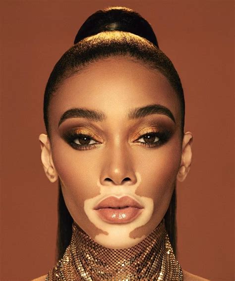 emo cunt  twitter vitiligo model model face winnie harlow