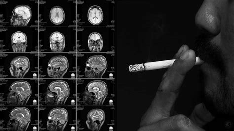 Here S How Nicotine Impacts The Brain 6 Minute Read