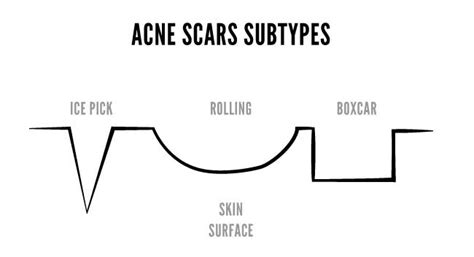 The 7 Types Of Scars And The Best Treatment Options For Them