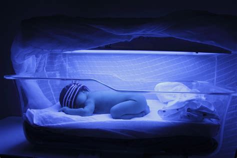 jaundice in newborns 6 things to know health