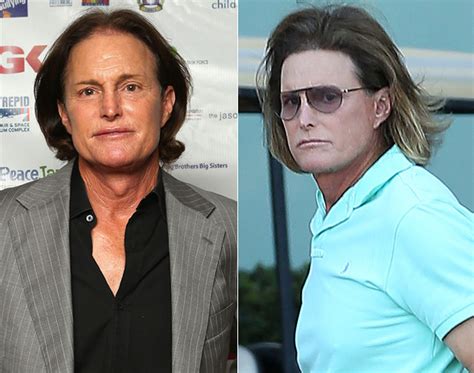 Bruce Jenner Steps Out After Alleged Adam’s Apple Surgery