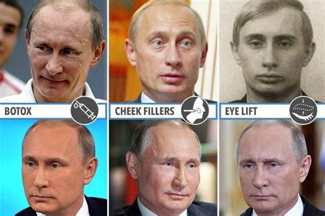 Has Putin Had Plastic Surgery Top Cosmetic Surgeon Reveals Exactly